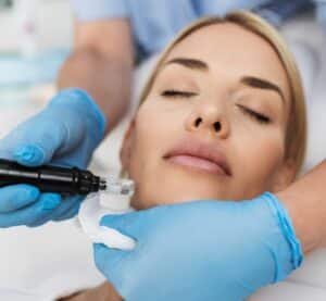 PIC_Microneedling_B_S_squere-2