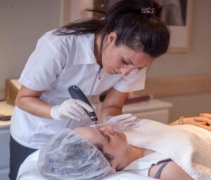 PIC_micrineedling2-1